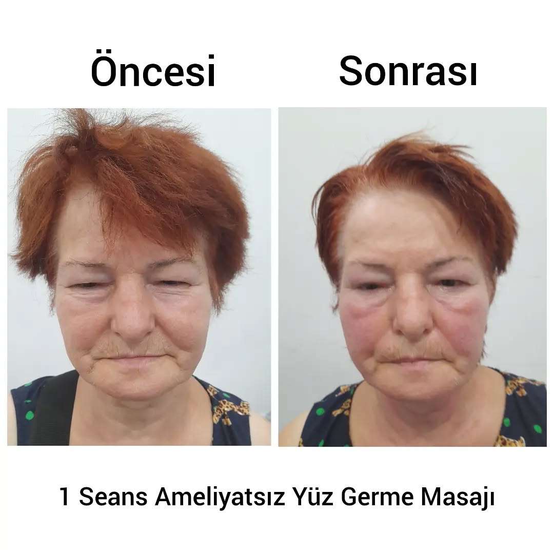 Öncesi Sonrası 1
