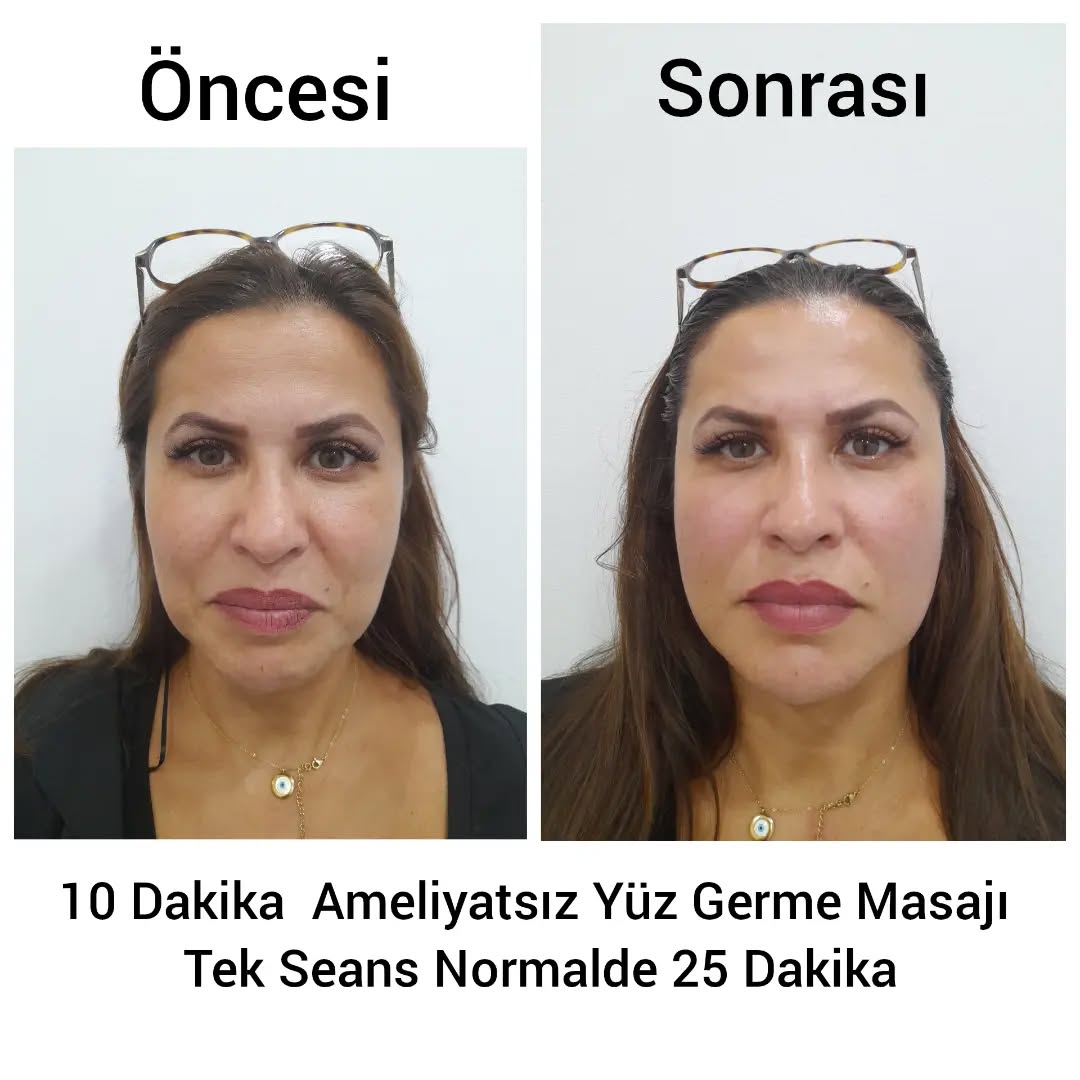 Öncesi Sonrası 2