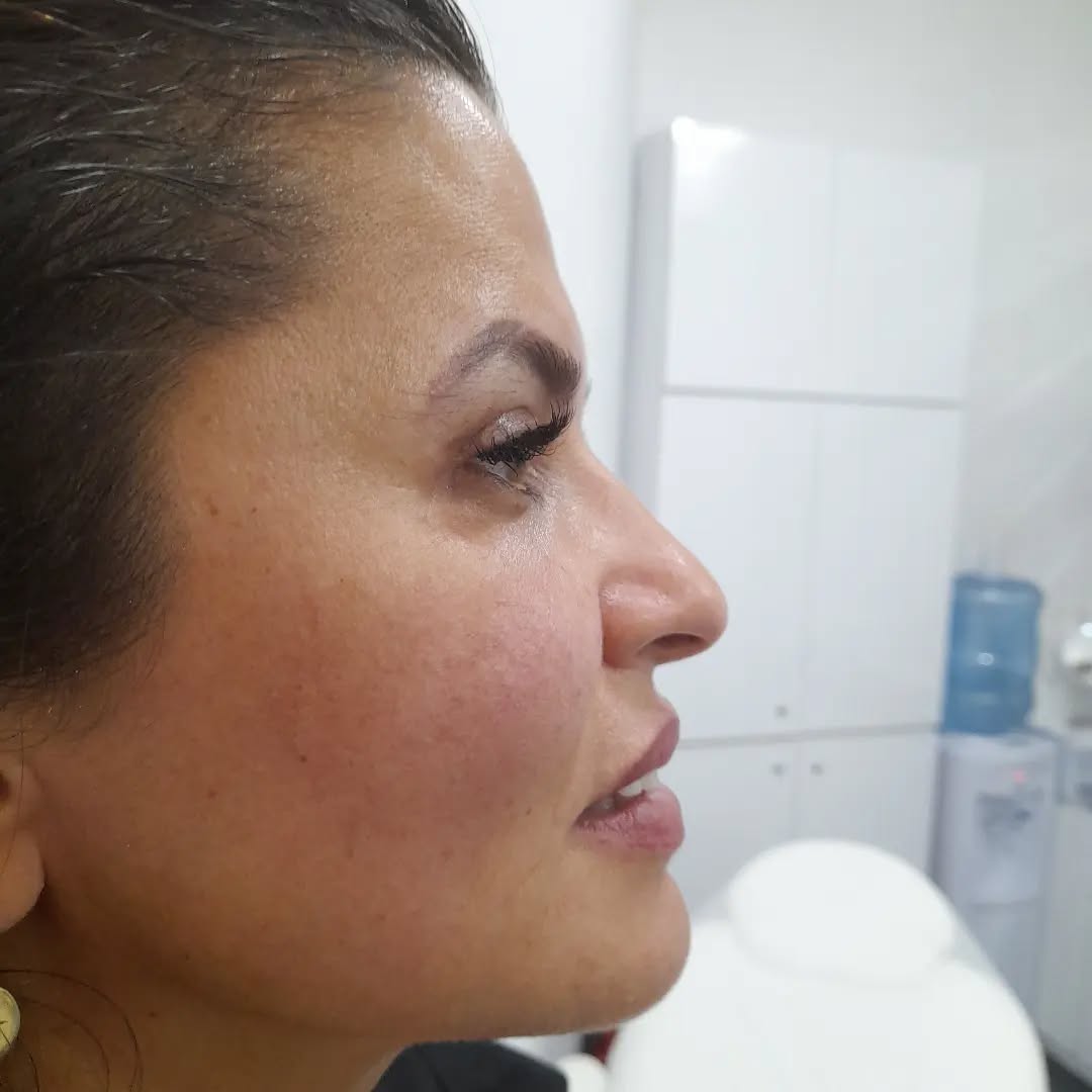 Yüz Germe Masajı